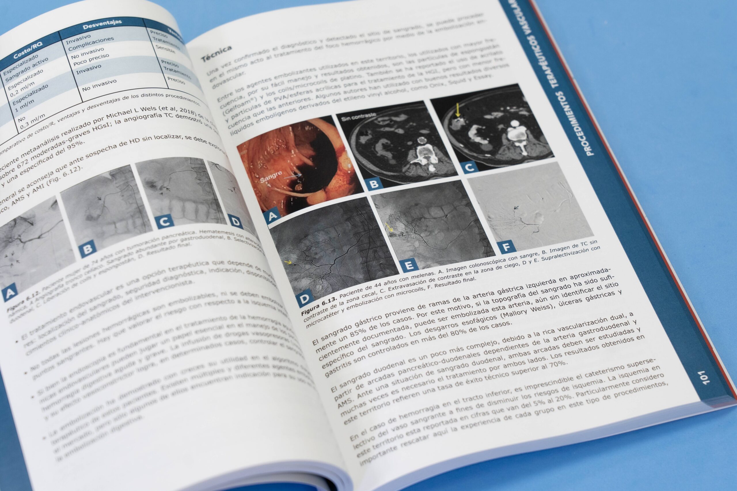 Manual Práctico de Radiología Intervencionista (Versión en español) - Imagen 3