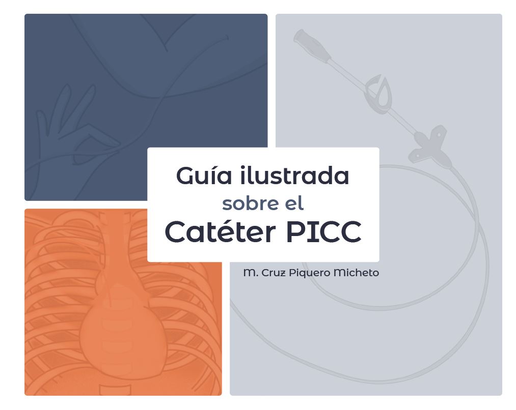 Guía sobre catéter PICC