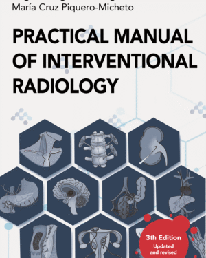 Practical Manual of Interventional Radiology (English version)