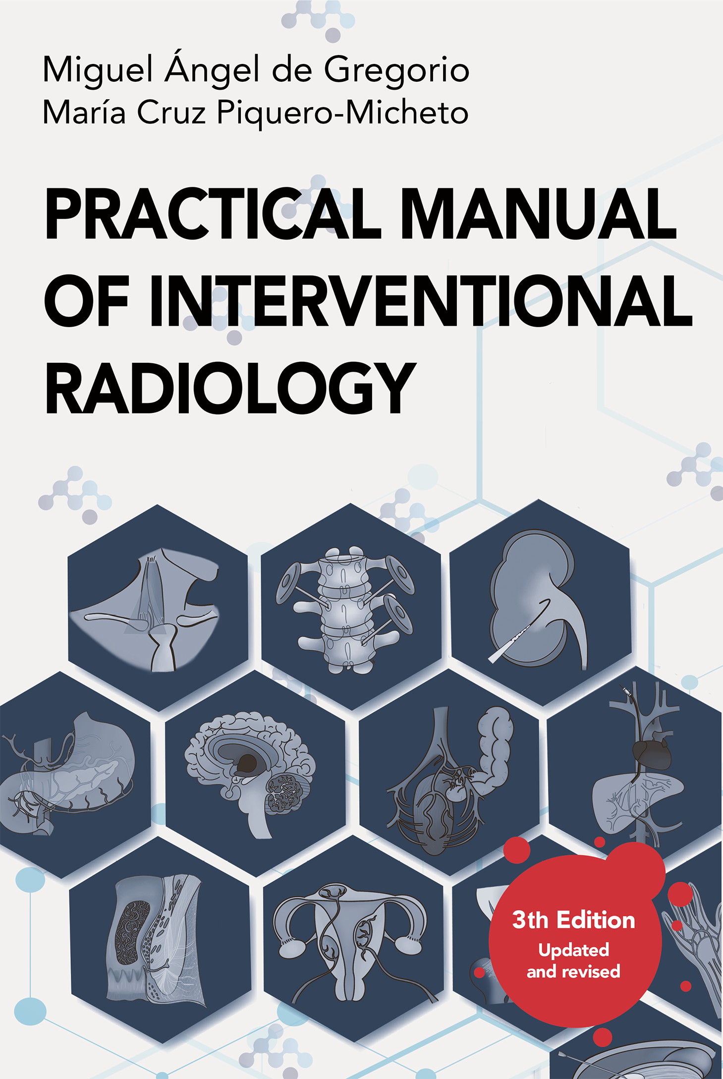 Practical Manual of Interventional Radiology (English version)