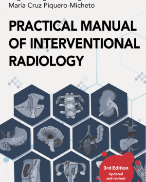 Practical Manual of Interventional Radiology (English version)