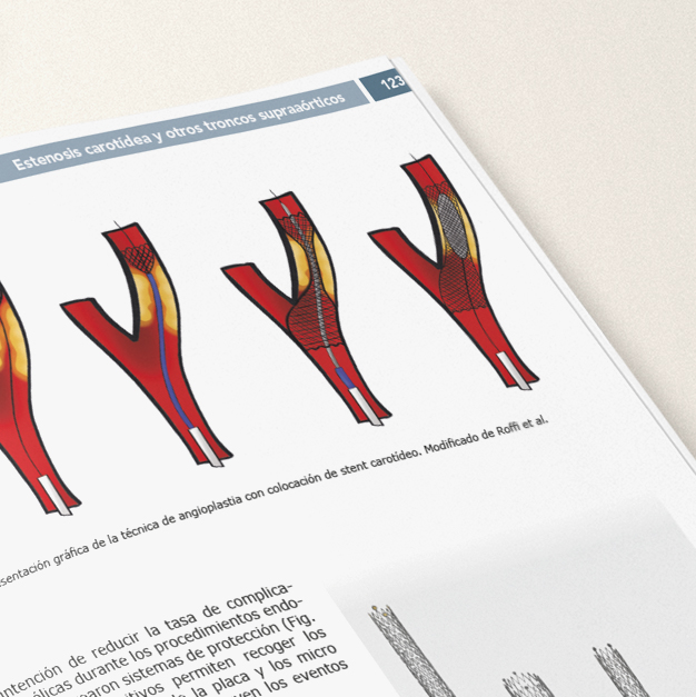 Radiología Intervencionista. Medio siglo innovando para la medicina (Versión en español) - Imagen 2
