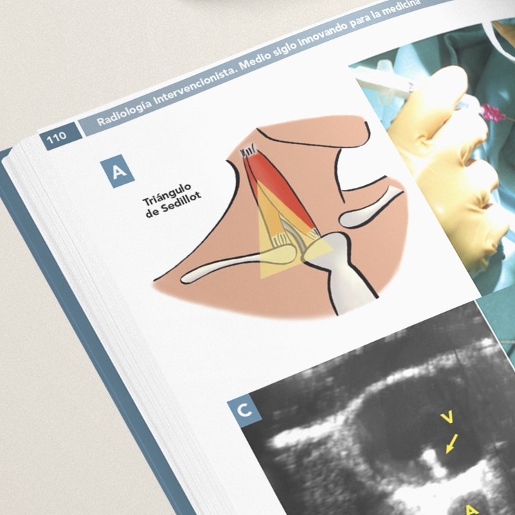 Radiología Intervencionista. Medio siglo innovando para la medicina (Versión en español) - Imagen 3