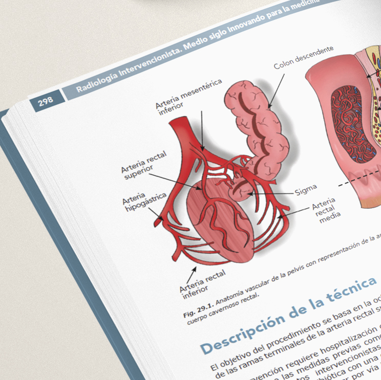 Radiología Intervencionista. Medio siglo innovando para la medicina (Versión en español) - Imagen 4