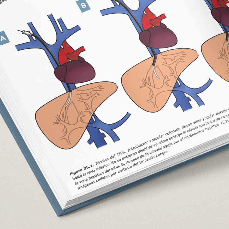 Radiología Intervencionista. Medio siglo innovando para la medicina (Versión en español) - Imagen 5